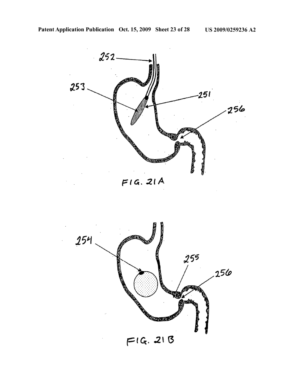 GASTRIC RETAINING DEVICES AND METHODS - diagram, schematic, and image 24