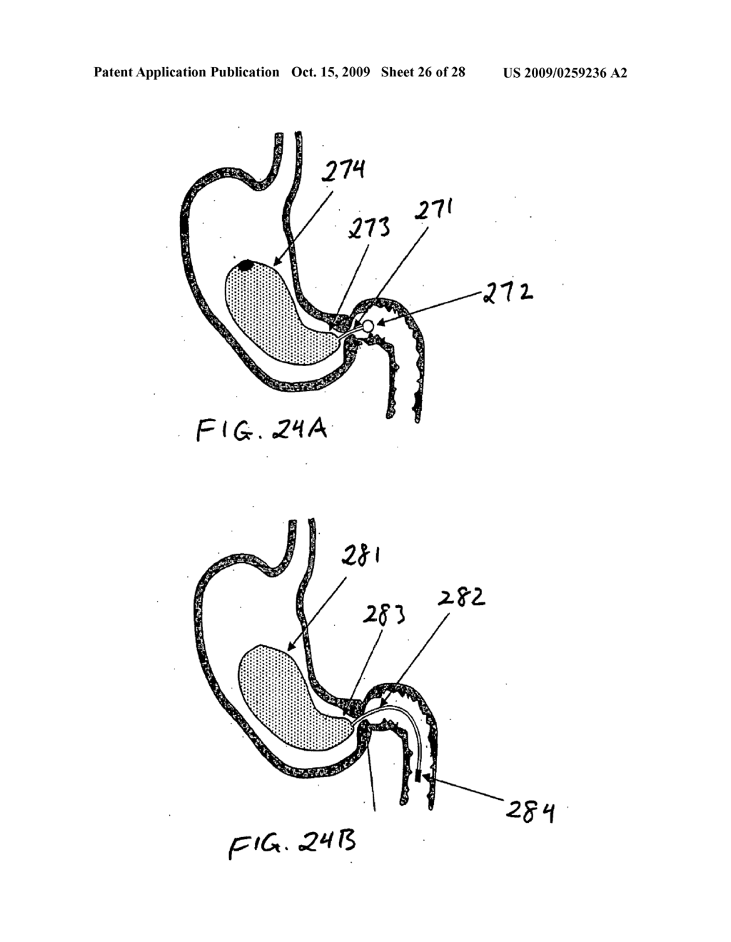 GASTRIC RETAINING DEVICES AND METHODS - diagram, schematic, and image 27