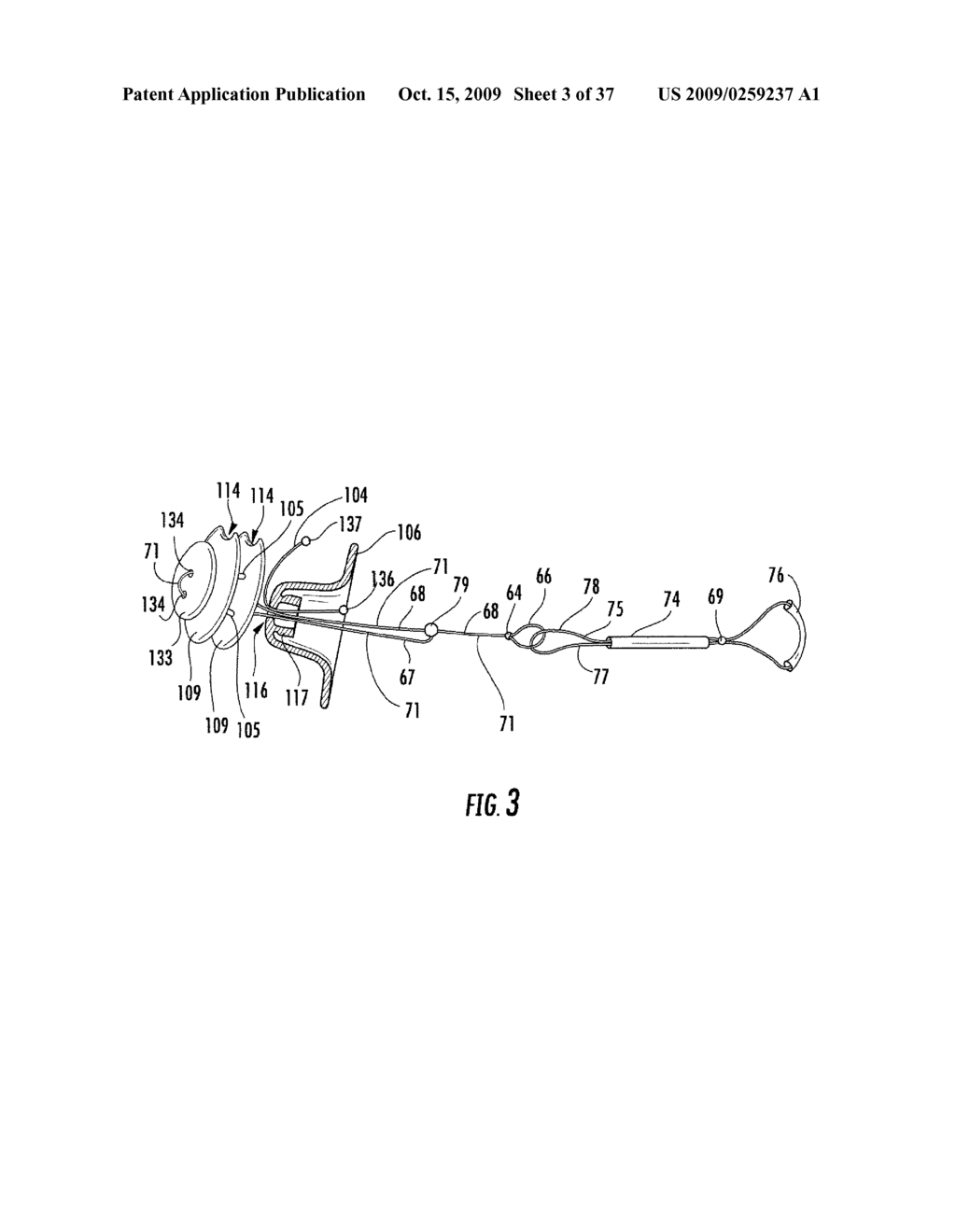 Pyloric valve devices and methods - diagram, schematic, and image 04