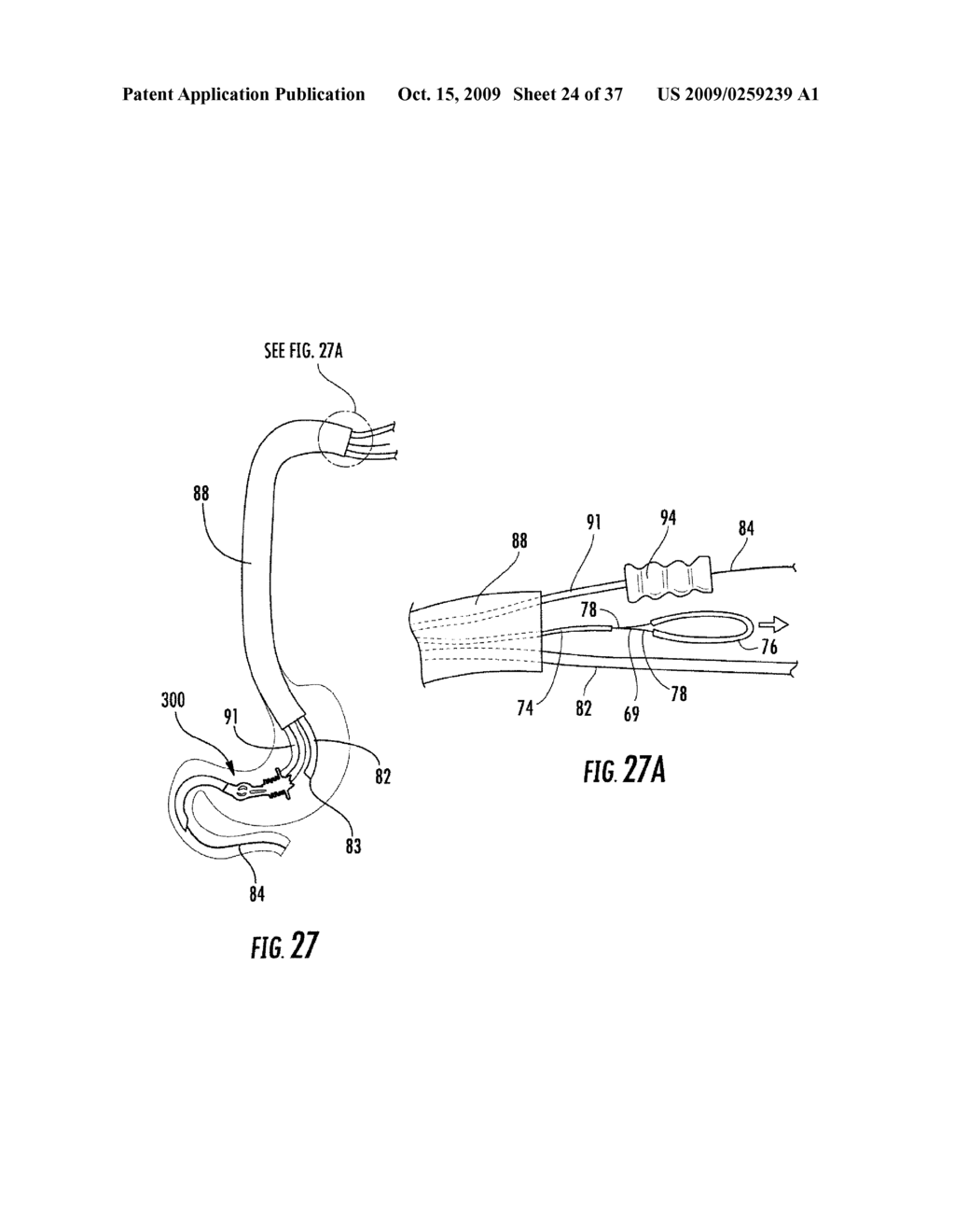 Pyloric valve devices and methods - diagram, schematic, and image 25