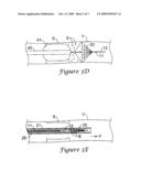 EMBOLI FILTRATION SYSTEM AND METHODS OF USE diagram and image