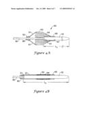 EMBOLI FILTRATION SYSTEM AND METHODS OF USE diagram and image