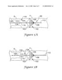 EMBOLI FILTRATION SYSTEM AND METHODS OF USE diagram and image