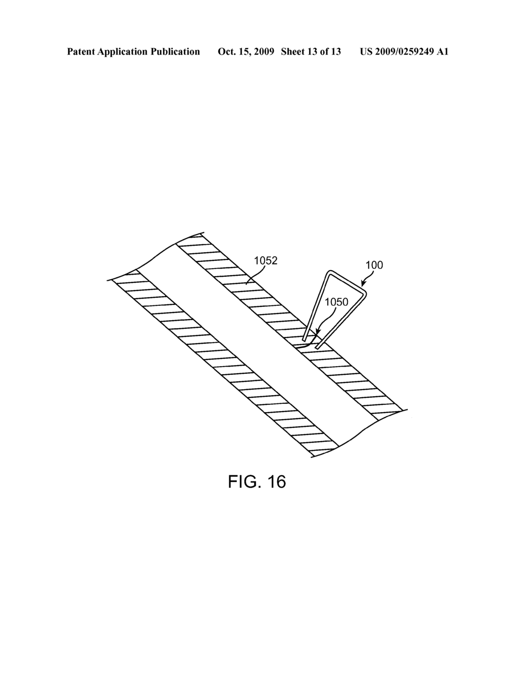 ARTERIOTOMY STAPLING SYSTEM FOR NON-ORTHOGONAL TISSUE TRACKS AND METHODS OF USE THEREIN - diagram, schematic, and image 14