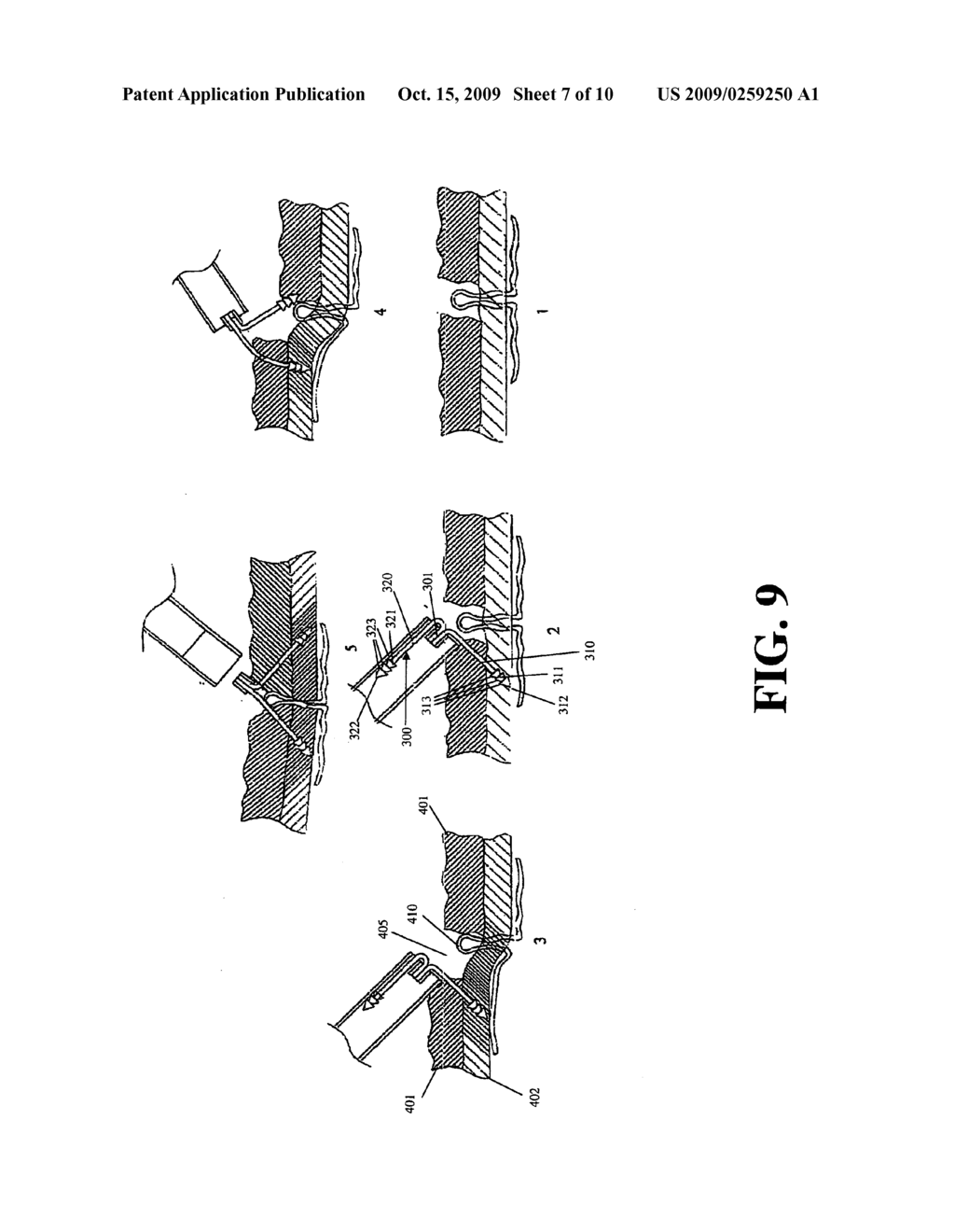 Endoscopic stapling device, related staples, and methods for use - diagram, schematic, and image 08