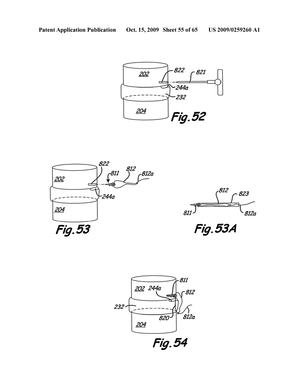 METHOD AND APPARATUS FOR THE TREATMENT OF THE INTERVERTEBRAL DISC ANNULUS - diagram, schematic, and image 56