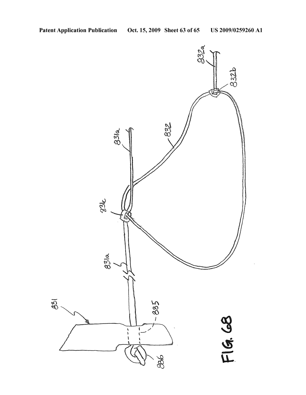 METHOD AND APPARATUS FOR THE TREATMENT OF THE INTERVERTEBRAL DISC ANNULUS - diagram, schematic, and image 64