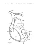 ELECTRONIC NETWORK COMPONENTS UTILIZING BIOCOMPATIBLE CONDUCTIVE ADHESIVES FOR DIRECT BODY FLUID EXPOSURE diagram and image