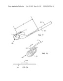 ELECTRONIC NETWORK COMPONENTS UTILIZING BIOCOMPATIBLE CONDUCTIVE ADHESIVES FOR DIRECT BODY FLUID EXPOSURE diagram and image