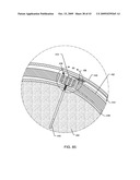 ELECTRONIC NETWORK COMPONENTS UTILIZING BIOCOMPATIBLE CONDUCTIVE ADHESIVES FOR DIRECT BODY FLUID EXPOSURE diagram and image