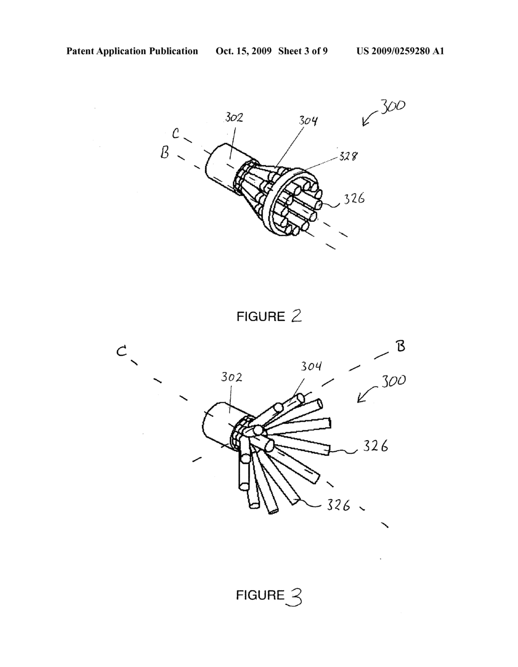 ELECTRICAL STIMULATION LEAD WITH BIOERODIBLE ANCHORS AND ANCHOR STRAPS - diagram, schematic, and image 04