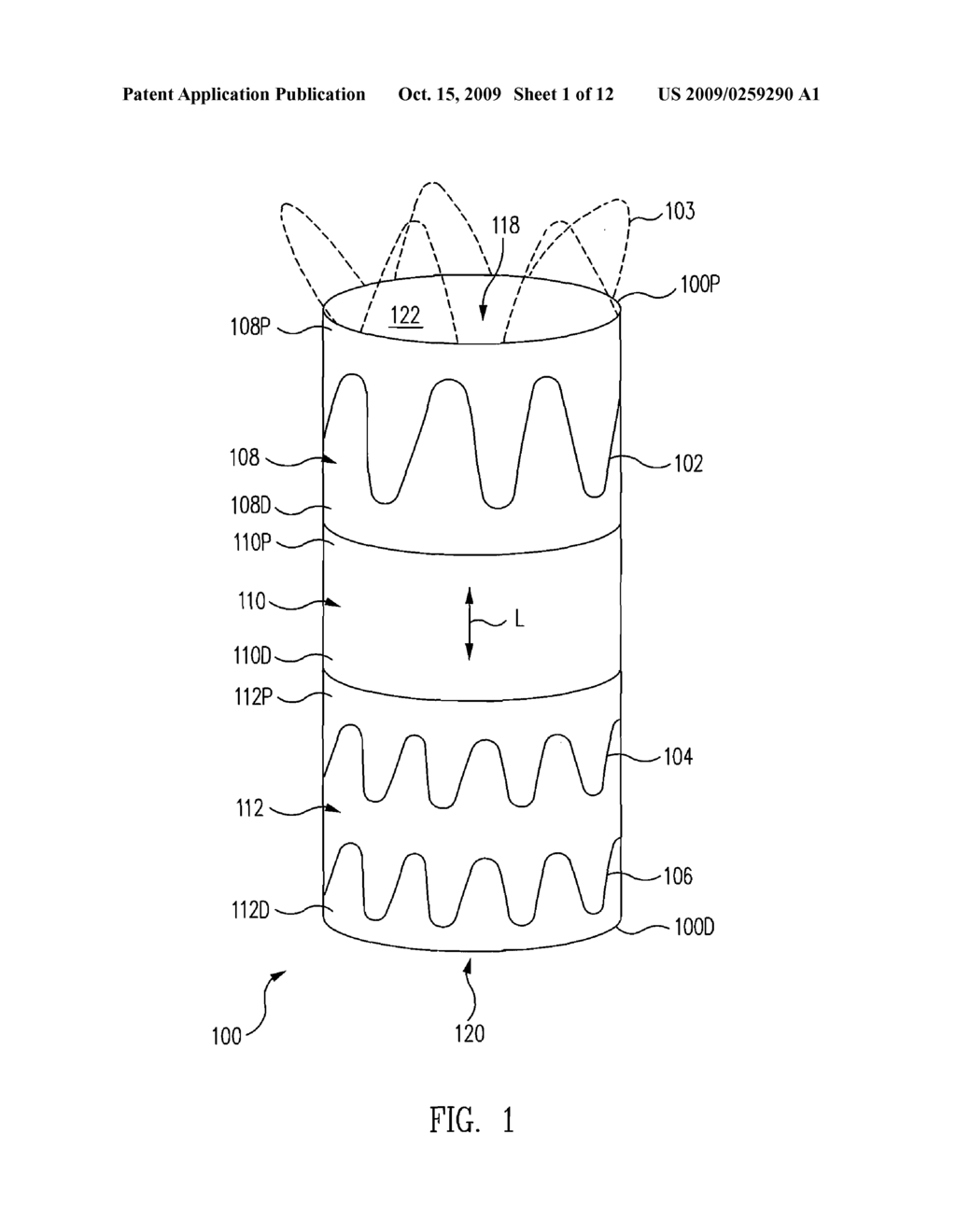 Fenestration Segment Stent-Graft and Fenestration Method - diagram, schematic, and image 02