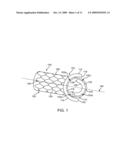 Side Branch Stent Having a Proximal Split Ring diagram and image