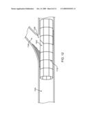 Side Branch Stent Having a Proximal Split Ring diagram and image