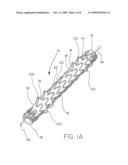 REMOVABLE STENT-GRAFT diagram and image