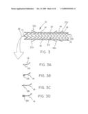 REMOVABLE STENT-GRAFT diagram and image