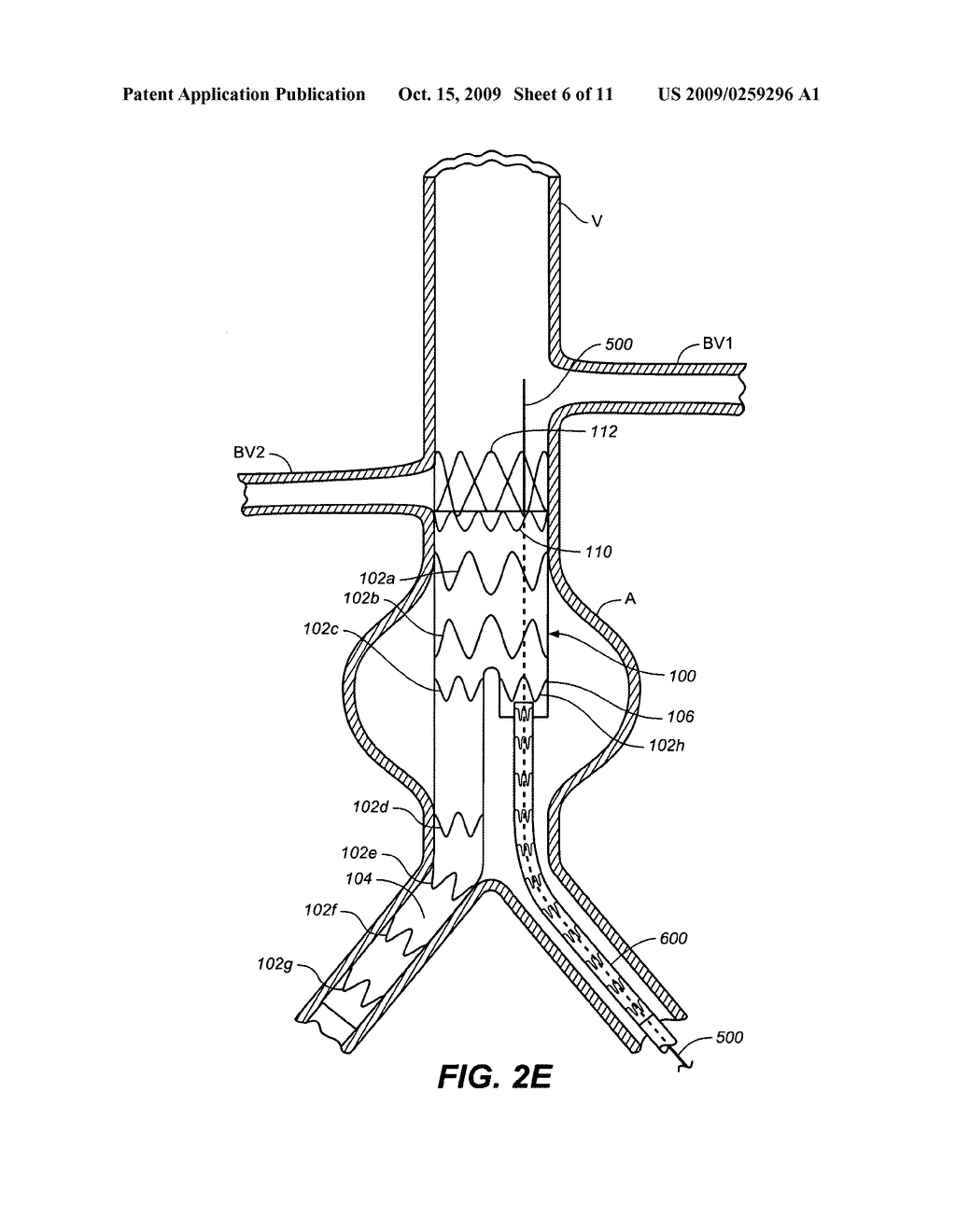 Gate Cannulation Apparatus and Methods - diagram, schematic, and image 07