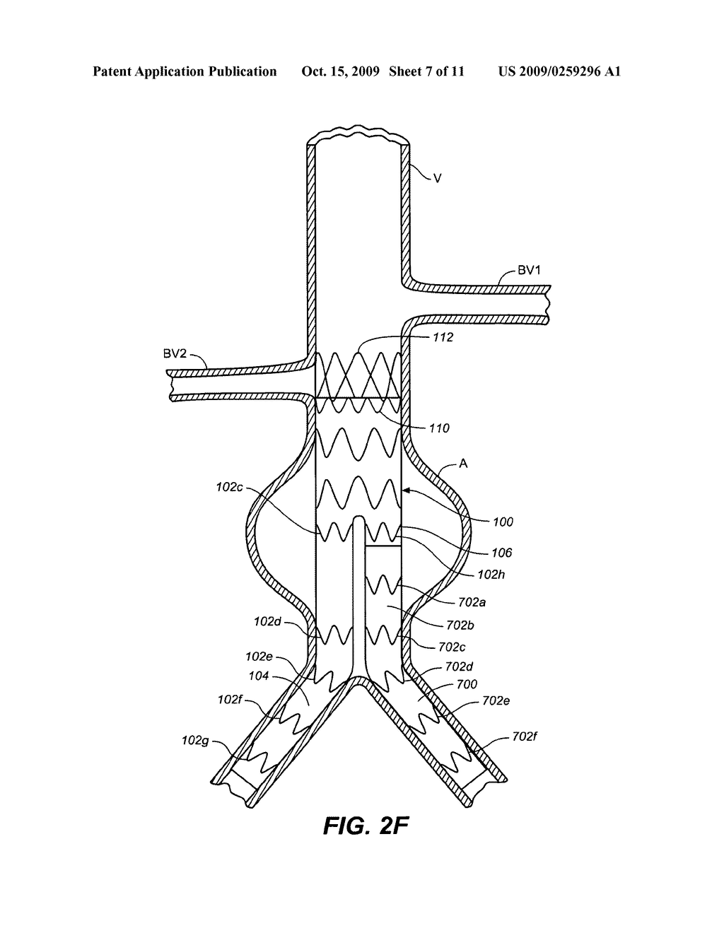 Gate Cannulation Apparatus and Methods - diagram, schematic, and image 08