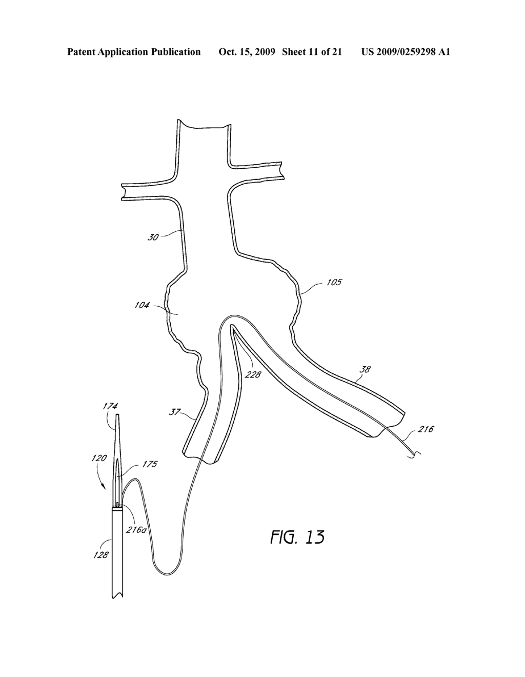 BIFURCATED GRAFT DEPLOYMENT SYSTEMS AND METHODS - diagram, schematic, and image 12