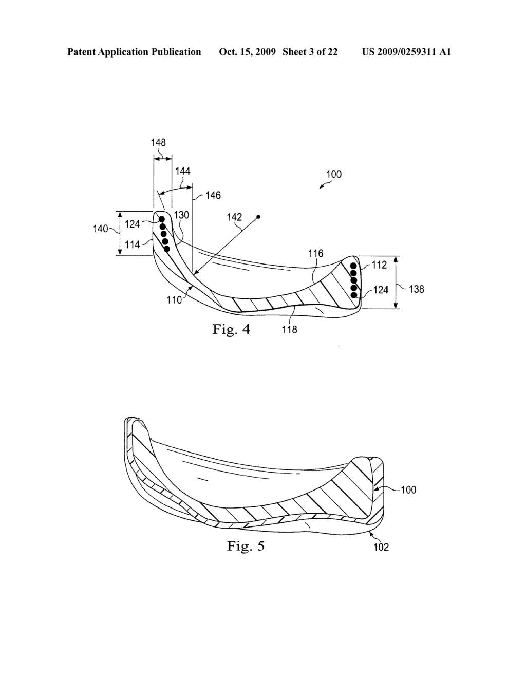 Tensioned Meniscus Prosthetic Devices and Associated Methods - diagram, schematic, and image 04