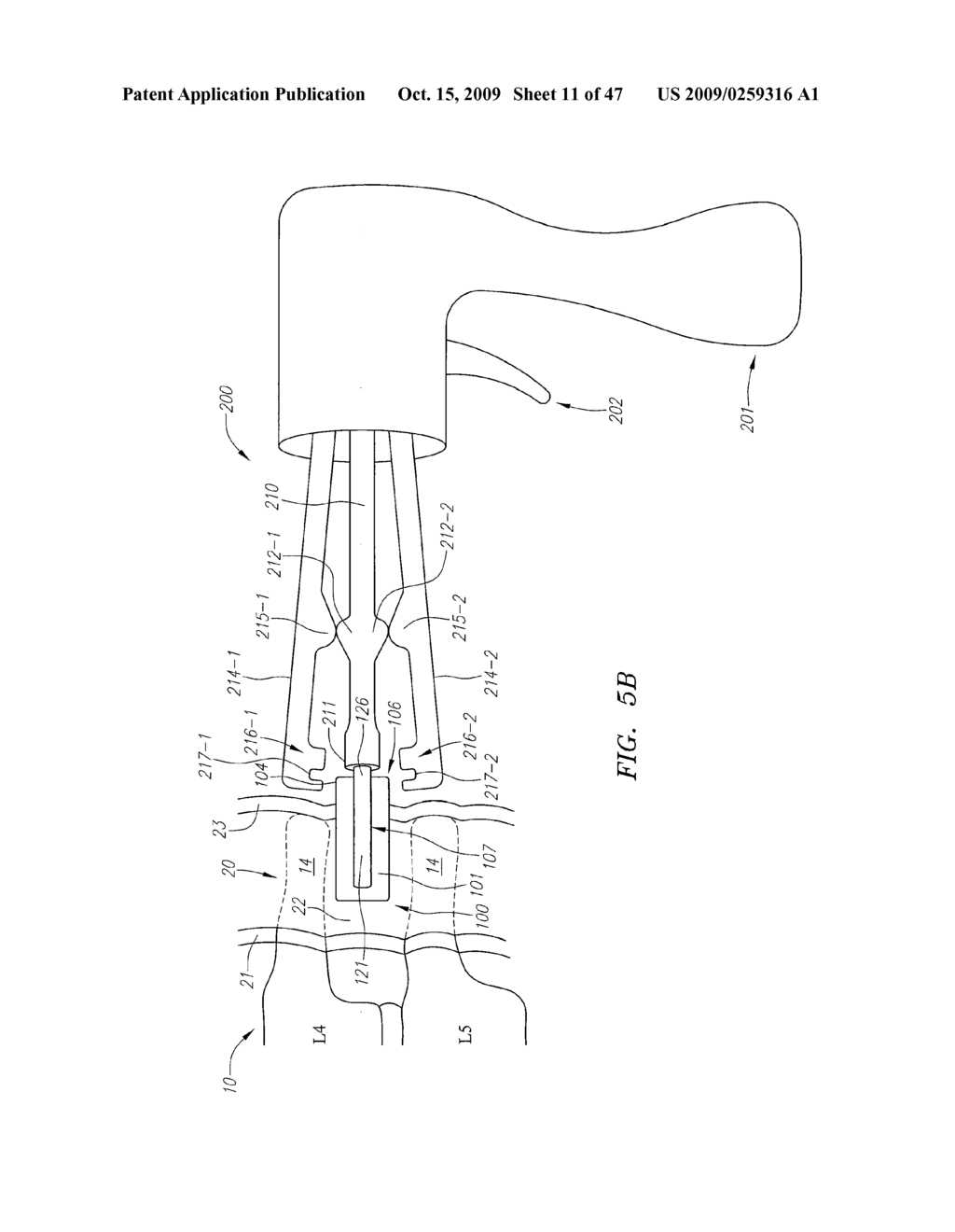 Spacer Devices and Systems for the Treatment of Spinal Stenosis and Methods for Using the Same - diagram, schematic, and image 12