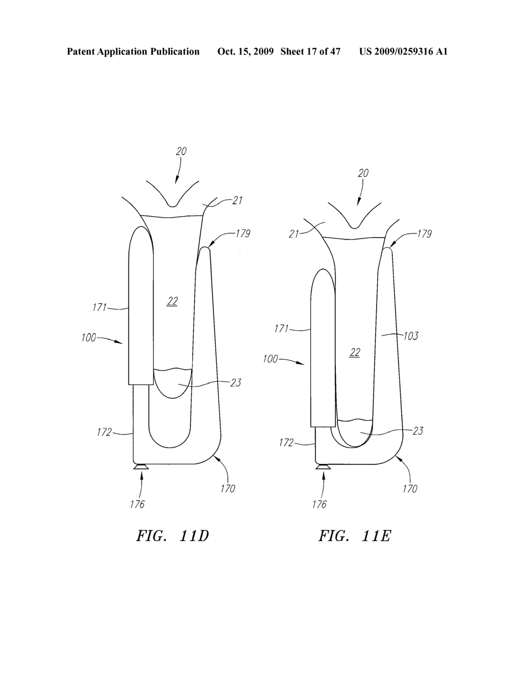 Spacer Devices and Systems for the Treatment of Spinal Stenosis and Methods for Using the Same - diagram, schematic, and image 18