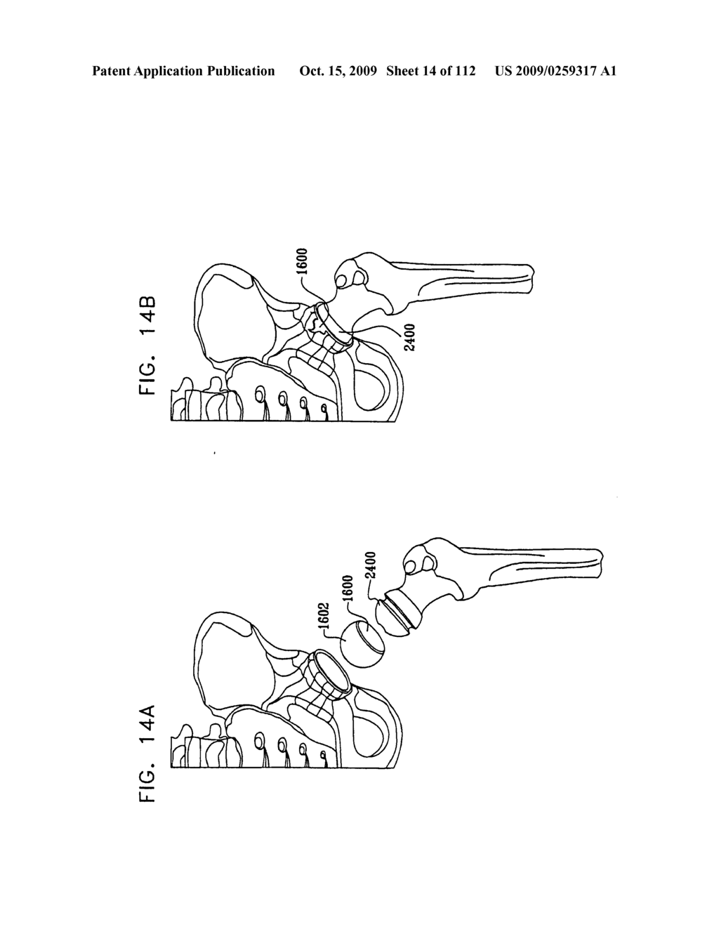 Cushion Bearing Implants for Load Bearing Applications - diagram, schematic, and image 15