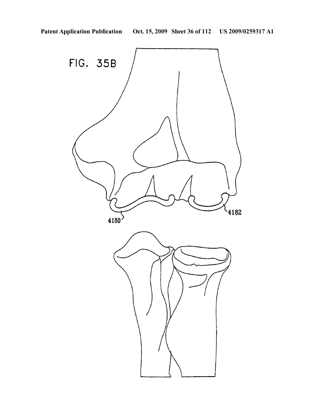 Cushion Bearing Implants for Load Bearing Applications - diagram, schematic, and image 37