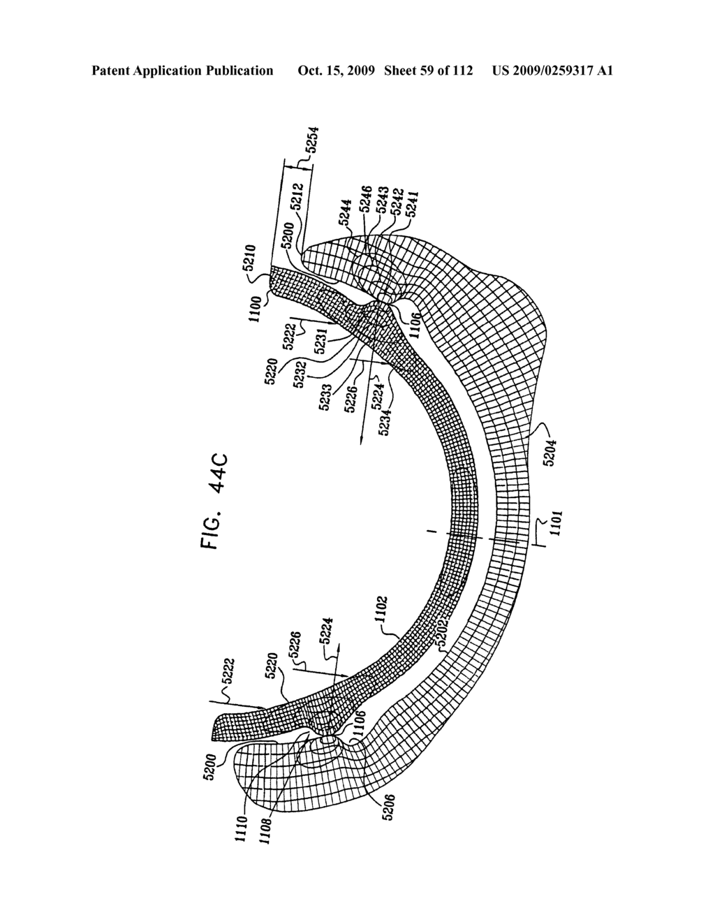 Cushion Bearing Implants for Load Bearing Applications - diagram, schematic, and image 60