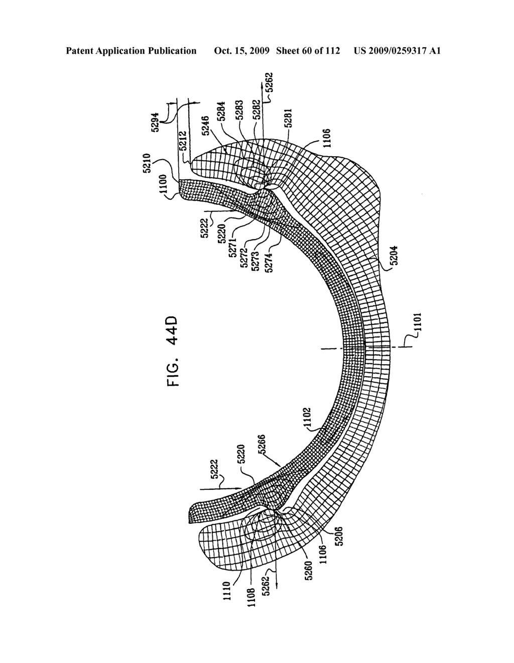 Cushion Bearing Implants for Load Bearing Applications - diagram, schematic, and image 61