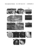 Methods and animal model for analyzing age-related macular degeneration diagram and image