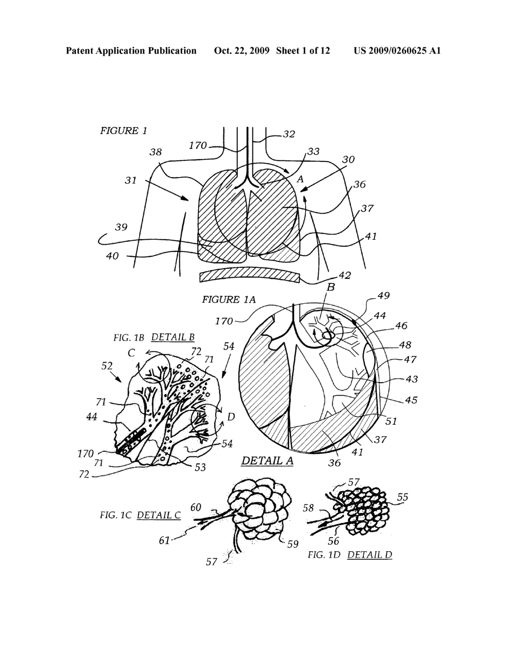 METHODS, SYSTEMS AND DEVICES FOR IMPROVING VENTILATION IN A LUNG AREA - diagram, schematic, and image 02