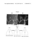 Sn-CONTAINING COPPER ALLOY AND METHOD OF MANUFACTURING THE SAME diagram and image