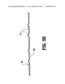 Electrosurgical Stapling Apparatus diagram and image