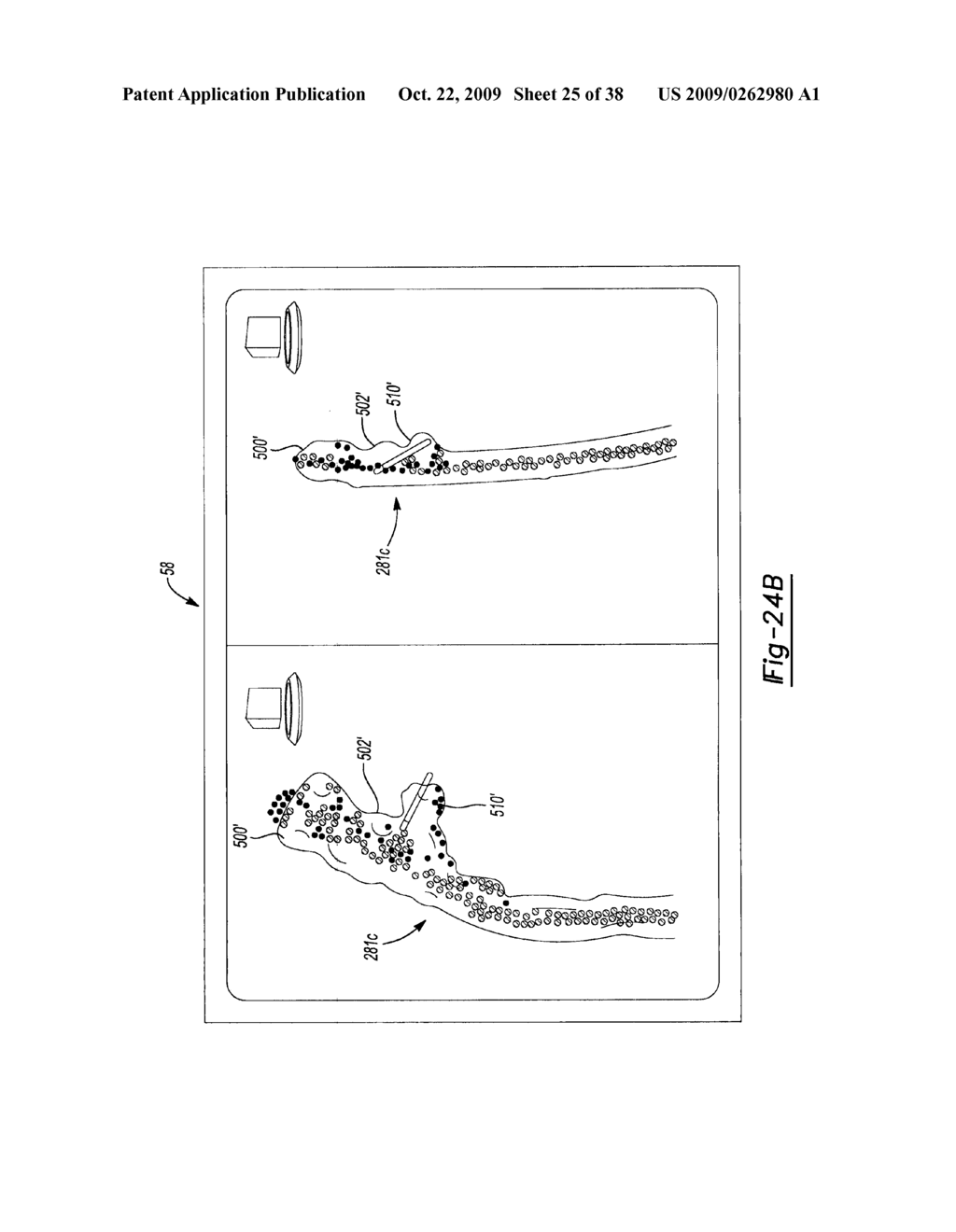 Method and Apparatus for Determining Tracking a Virtual Point Defined Relative to a Tracked Member - diagram, schematic, and image 26