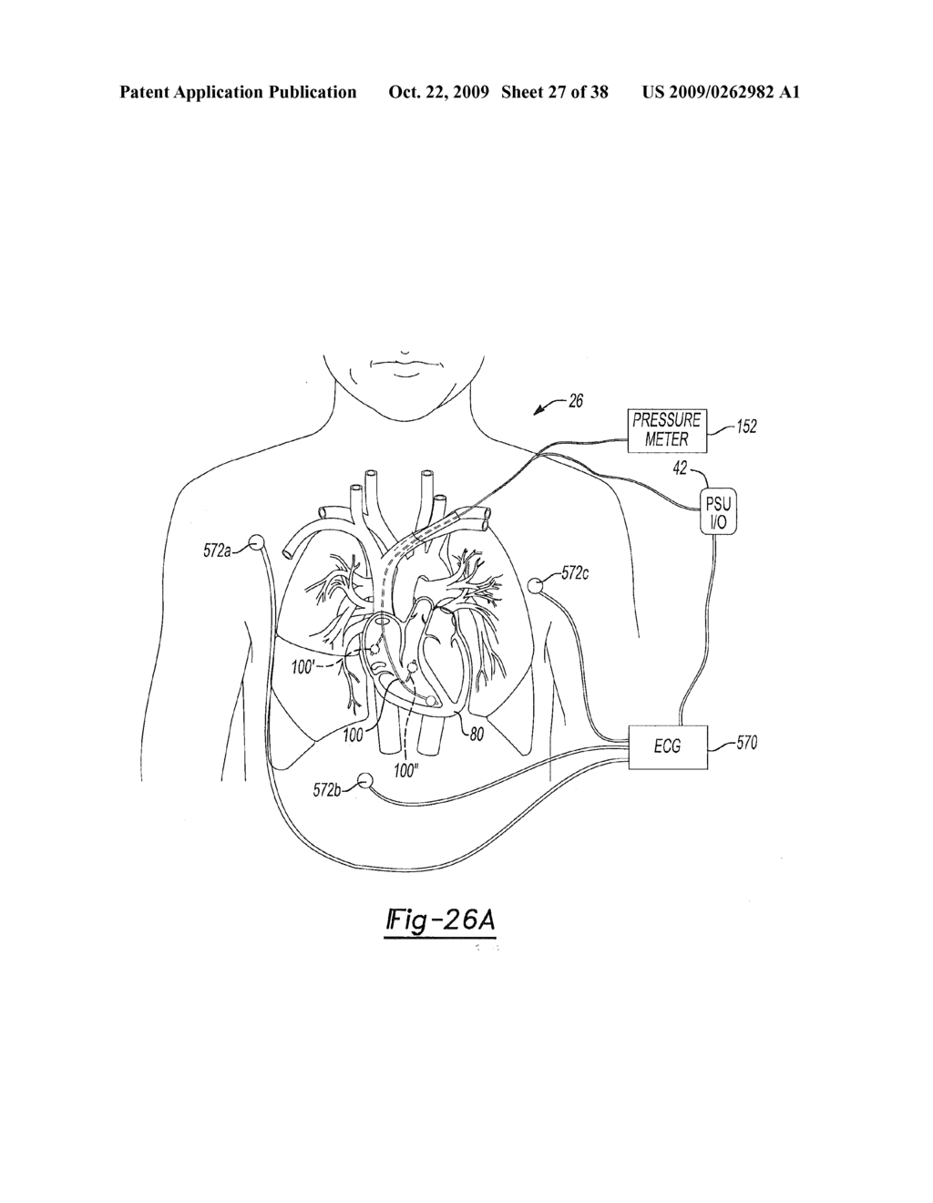 Determining a Location of a Member - diagram, schematic, and image 28