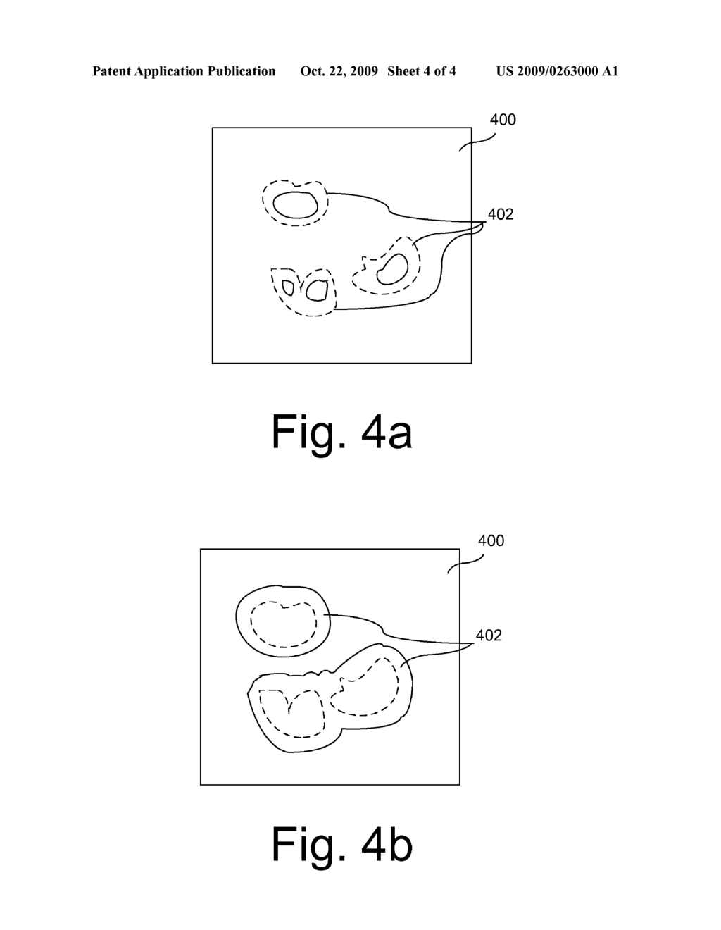 Iterative Segmentation of Images for Computer-Aided Detection - diagram, schematic, and image 05