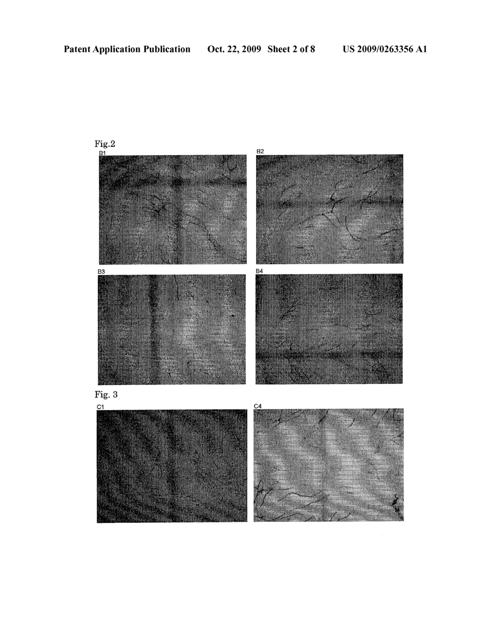 ANTI-ANGIOGENIC COMPOSITION COMPRISING GRAIN-DERIVED COMPONENT AS ACTIVE INGREDIENT - diagram, schematic, and image 03