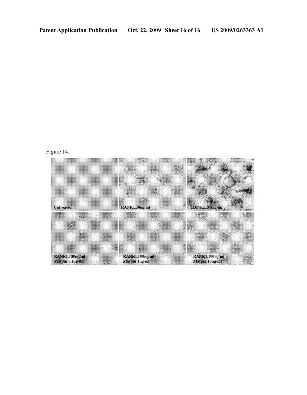 Compositions and Methods For Treating Bone Formation Disorders - diagram, schematic, and image 17