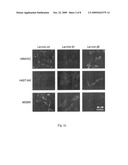 MONOCLONAL ANTIBODIES FOR INHIBITION OF LAMININ-8 EXPRESSION TO INHIBIT HUMAN GLIOMAS diagram and image