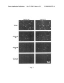 MONOCLONAL ANTIBODIES FOR INHIBITION OF LAMININ-8 EXPRESSION TO INHIBIT HUMAN GLIOMAS diagram and image