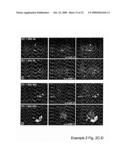 MEANS AND METHODS FOR MANIPULATING SEQUENTIAL PHAGOLYSOMALCYTOSOLIC TRANSLOCATION OF MYCOBACTERIA, AND USES THEREOF diagram and image