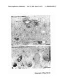 MEANS AND METHODS FOR MANIPULATING SEQUENTIAL PHAGOLYSOMALCYTOSOLIC TRANSLOCATION OF MYCOBACTERIA, AND USES THEREOF diagram and image