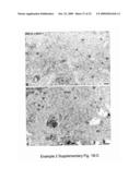 MEANS AND METHODS FOR MANIPULATING SEQUENTIAL PHAGOLYSOMALCYTOSOLIC TRANSLOCATION OF MYCOBACTERIA, AND USES THEREOF diagram and image