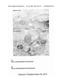 MEANS AND METHODS FOR MANIPULATING SEQUENTIAL PHAGOLYSOMALCYTOSOLIC TRANSLOCATION OF MYCOBACTERIA, AND USES THEREOF diagram and image