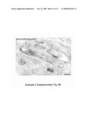 MEANS AND METHODS FOR MANIPULATING SEQUENTIAL PHAGOLYSOMALCYTOSOLIC TRANSLOCATION OF MYCOBACTERIA, AND USES THEREOF diagram and image