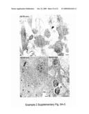 MEANS AND METHODS FOR MANIPULATING SEQUENTIAL PHAGOLYSOMALCYTOSOLIC TRANSLOCATION OF MYCOBACTERIA, AND USES THEREOF diagram and image