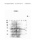 METHODS OF STIMULATING AN IMMUNE RESPONSE AGAINST PROSTATE SPECIFIC ANTIGEN diagram and image