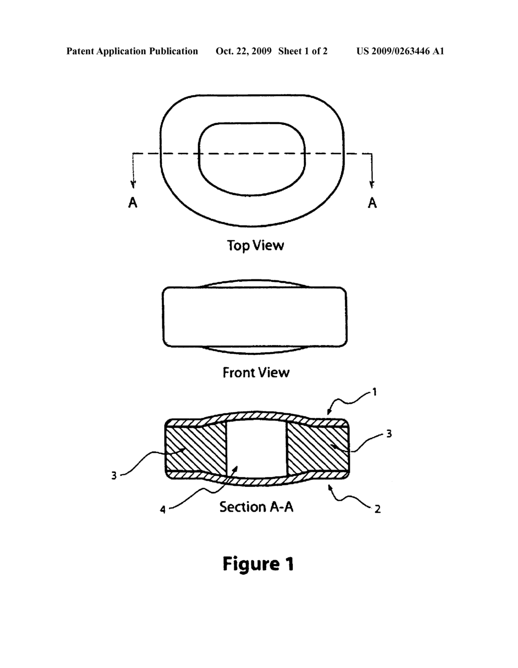 METHOD OF MAKING LOAD BEARING HYDROGEL IMPLANTS - diagram, schematic, and image 02