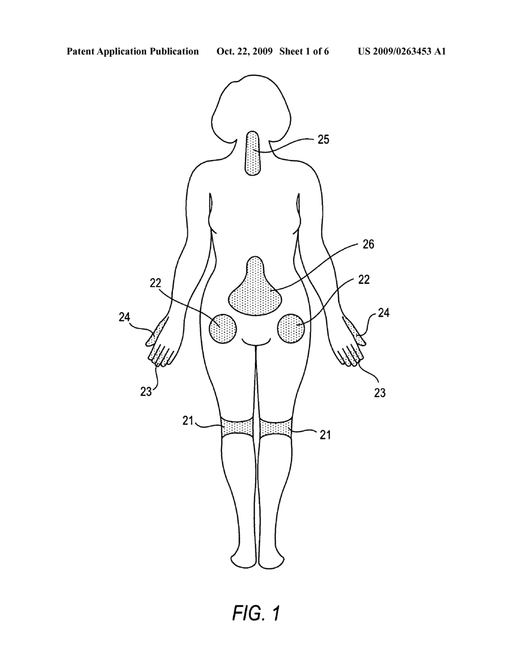 Methods and Compositions for Treating Pain Comprising a Statin - diagram, schematic, and image 02